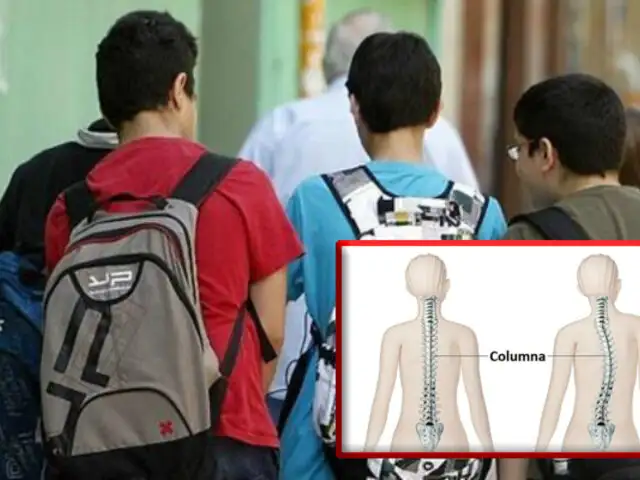 De regreso al colegio: mal uso de las mochilas podría causar males en la salud
