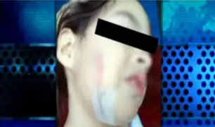 SJL: padres denuncian que niña de 4 años sufrió corte en el rostro en colegio