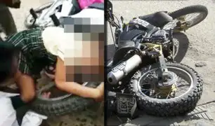 Tarapoto: brazo de niña queda atrapado entre la llanta y cadena de motocicleta