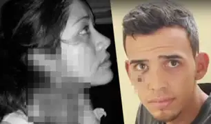 Los Olivos: extranjero ataca con una navaja a joven por robarle el celular