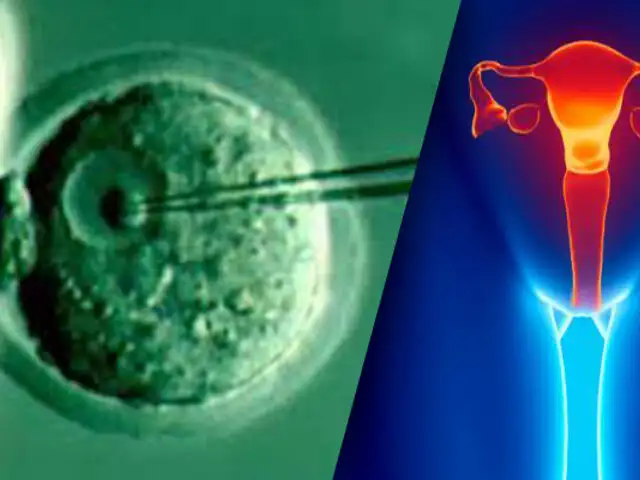Dinamarca: científicos desarrollan ovarios artificiales para mujeres que padecieron cáncer