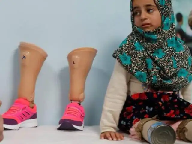 Turquía: niña con desorden congénito que caminaba con latas, recibió prótesis