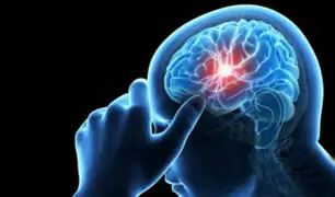 Yola Polastry: conozca los posibles síntomas del aneurisma cerebral