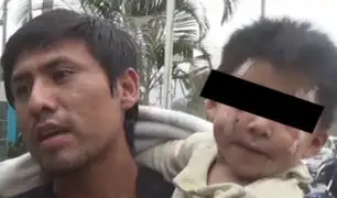 Huachipa: gallo de pelea desfigura a niño de un año