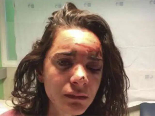 Dramático relato de turista estadounidense que fue golpeada y violada en España