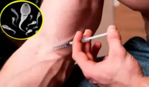 Irlanda: hombre se inyecta su propio semen para curar su dolor de espalda