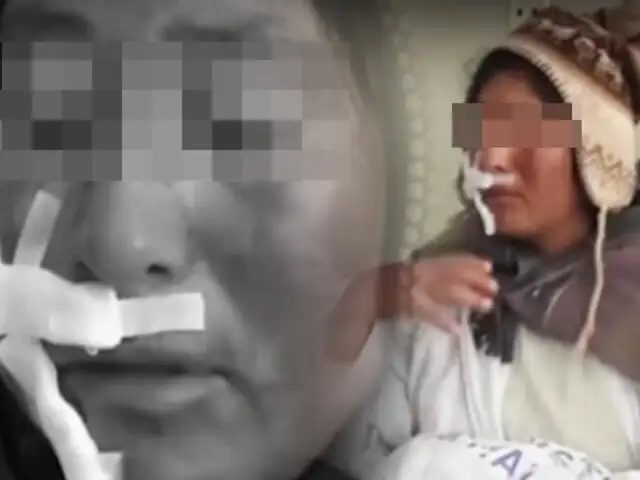 Mujer es acuchillada y recibe profundo corte en el rostro por parte de su pareja en Puno