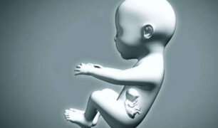 Colombia: bebé nació "embarazada" de su hermano gemelo