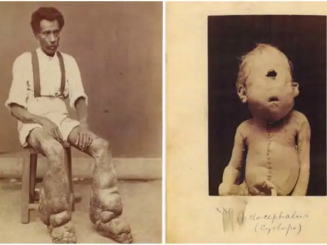 #ElTop10: las fotografías médicas más perturbadoras de la historia