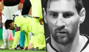 Champions League: Lionel Messi sufrió un corte en el rostro enfretando al  Manchester United