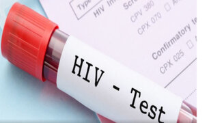 Pakistán: 90 personas fueron contaminadas con VIH por médico que tiene el virus