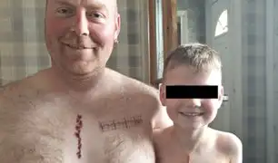 Hombre se tatúa cicatriz idéntica a la de su hijo que fue operado