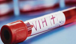 EEUU: eliminan el VIH del genoma de animales vivos