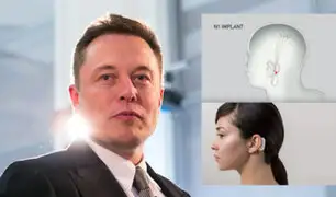 Elon Musk presenta implante que permite controlar tu celular con la mente