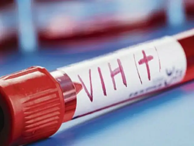 Confirman segundo caso de curación del VIH a nivel mundial