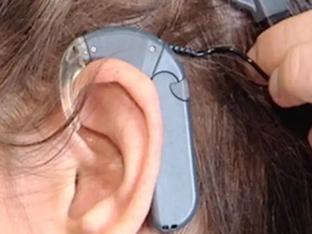 Santa Anita: Depincri investiga robo de implante auricular a niña con sordera