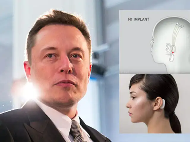 Elon Musk presenta implante que permite controlar tu celular con la mente