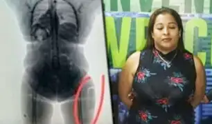 Colombia: detienen a mujer que quiso traficar cocaína líquida implantada en sus muslos
