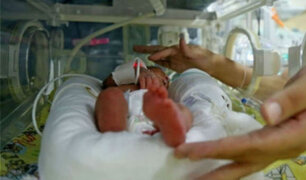 Arequipa: de 63 bebés fallecidos este año, 40 murieron por falta de incubadoras