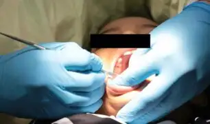 Adolescente soporta dolor de muelas durante un año y termina con agujero en mandíbula
