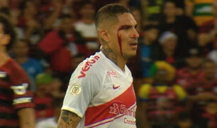 Sangrando y expulsado: Internacional de Paolo perdió por 1 a 3 contra Flamengo