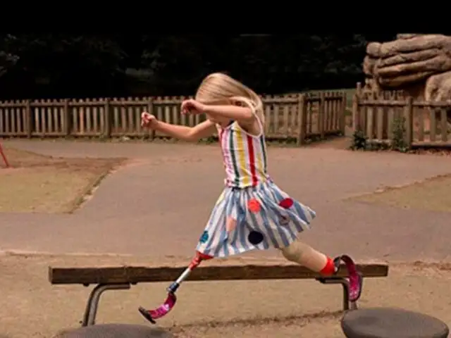 EEUU: niña con piernas amputadas desfila en Semana de la Moda de Nueva York