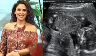 Adriana Quevedo anuncia su embarazo y se emociona hasta las lágrimas
