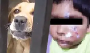 Callao: niño atacado por perro recibe 15 puntos en el rostro
