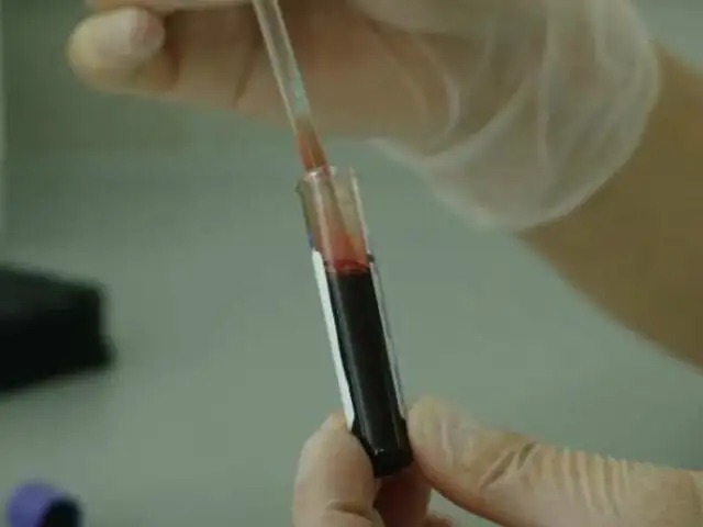 Crean sangre artificial que se adapta a cualquier grupo sanguíneo