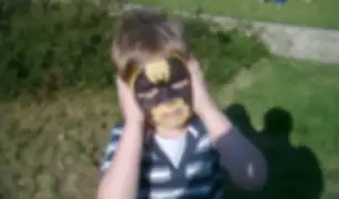 La historia de la bebé nacida con una 'máscara de Batman'