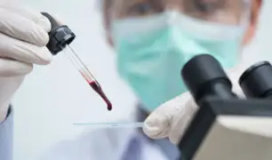 Japón: crean aparato capaz de detectar hasta 13 tipos de cáncer con una gota de sangre