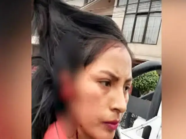 El Agustino: mujer arranca la oreja a estudiante con una mordida
