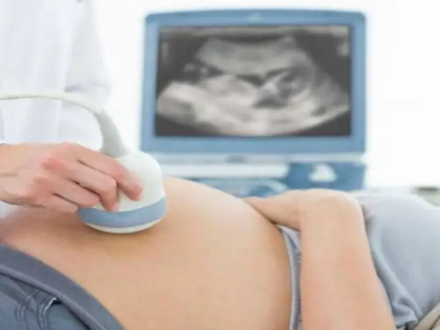 Mujer embarazada asegura ver a su padre fallecido en ultrasonido de su bebé
