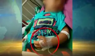 Metro de Lima: niño casi pierde dedos en escalera eléctrica de estación Caja de Agua