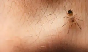 ¿Cómo evitar ser picado o mordido por insectos este verano?