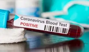 Coronavirus: se registra el primer caso en África