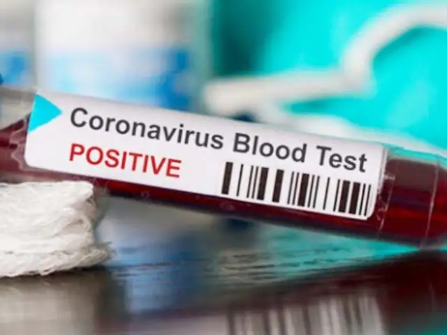 Coronavirus: se registra el primer caso en África