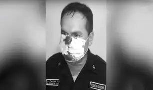 Comas: sujeto indocumentado golpea y rompe la nariz a Policía durante intervención