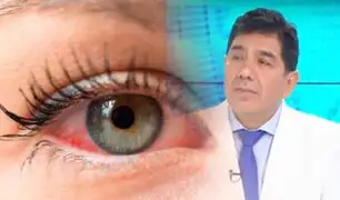 Coronavirus y conjuntivitis: estudios sugieren que podría manifestarse con síntomas oculares