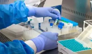 Contraloría: insumos para pruebas moleculares se entregaron sin regulación a clínicas privadas