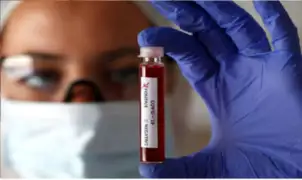 Aprueban protocolo para usar plasma de recuperados de coronavirus para curar a infectados
