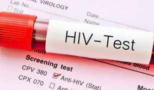 Alertan sobre nueva variante de VIH que se desarrolla más rápido