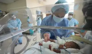 Hospital Rebagliati: Bebé que nació con 580 gramos superó la COVID-19