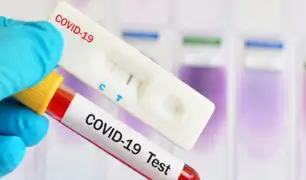 COVID-19 dejaría un déficit en una proteína presente en la sangre
