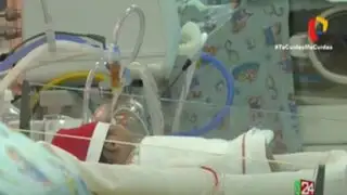 Arequipa: bebés siameses separados tras compleja operación serán dados de alta