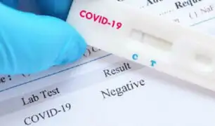 COVID-19: ¿por qué se sigue usando pruebas "rápidas" si son poco efectivas?