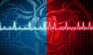 Arritmias cardíacas serían las secuelas más peligrosa de la COVID-19, según expertos