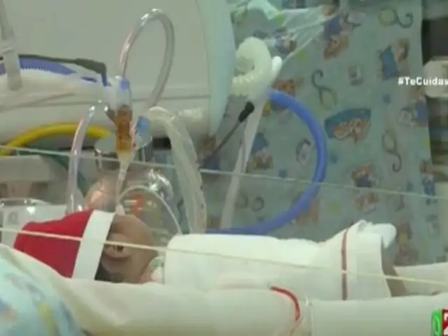 Arequipa: bebés siameses separados tras compleja operación serán dados de alta