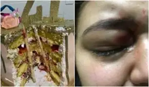 Mujer estuvo a punto de perder uno de sus ojos tras morder torta que tenía varillas