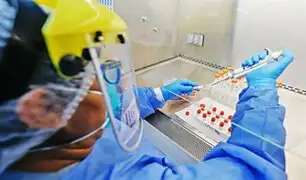 Hospital Hipólito Unanue ya viene procesando pruebas moleculares rápidas hechas en Perú